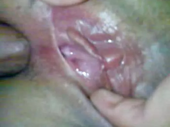 Ivy’ubusambanyi bwo mu nda n’umukobwa w’Umuturuki.